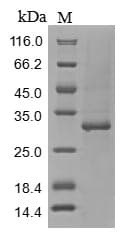 Mouse Tenascin Protein (Recombinant 10His, N-terminus + Myc, C-terminus)