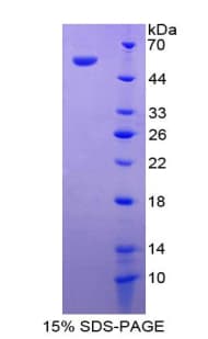 Human CIDEA / CIDE-A Protein (Recombinant His-GST)