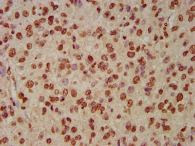 Polyclonal Rabbit anti-Human HIST1H3A Antibody (IHC, WB)