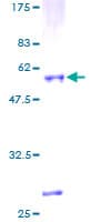 Human IGFBP4 Protein (Recombinant GST)