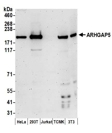Polyclonal Rabbit anti-Human ARHGAP5 / RhoGAP5 Antibody (aa1452-1502, WB)
