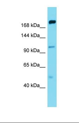 Polyclonal Rabbit anti-Human MAP4K5 Antibody (C-Terminus, WB)