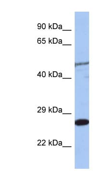 MIS12 Antibody (C-Terminus)