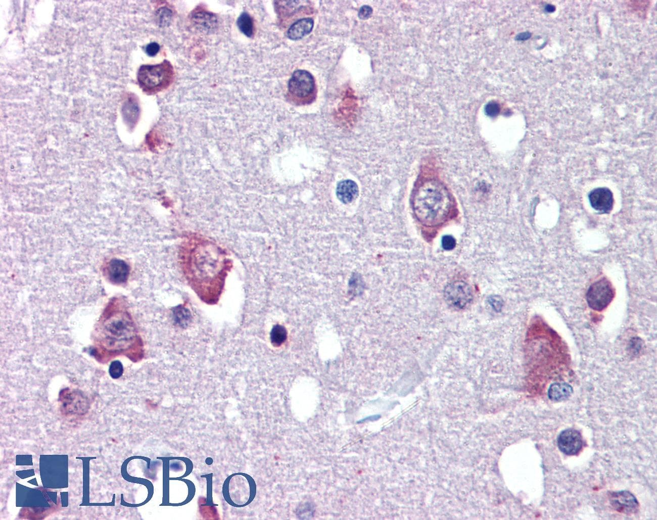 PathPlus™ Polyclonal Goat anti-Human BDNF Antibody (aa183-194, IHC, IF)