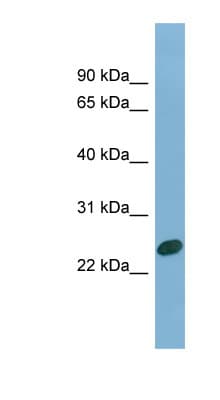 CHMP1B Antibody (aa35-84)