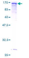 Human VCL / Vinculin Protein (Recombinant GST)