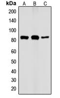 CHUK / IKKA / IKK Alpha Antibody (phospho-Thr23)