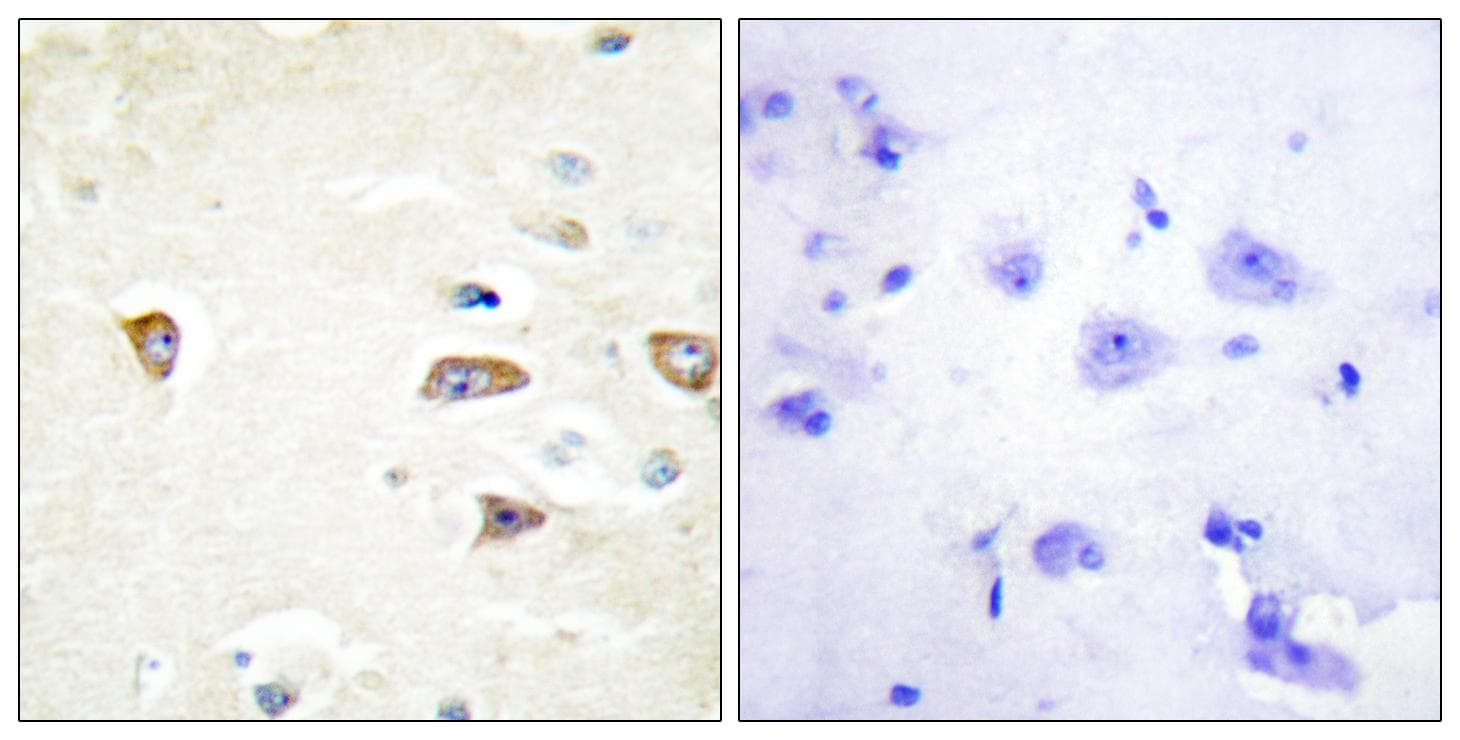 CDC42BPB / MRCKB Antibody