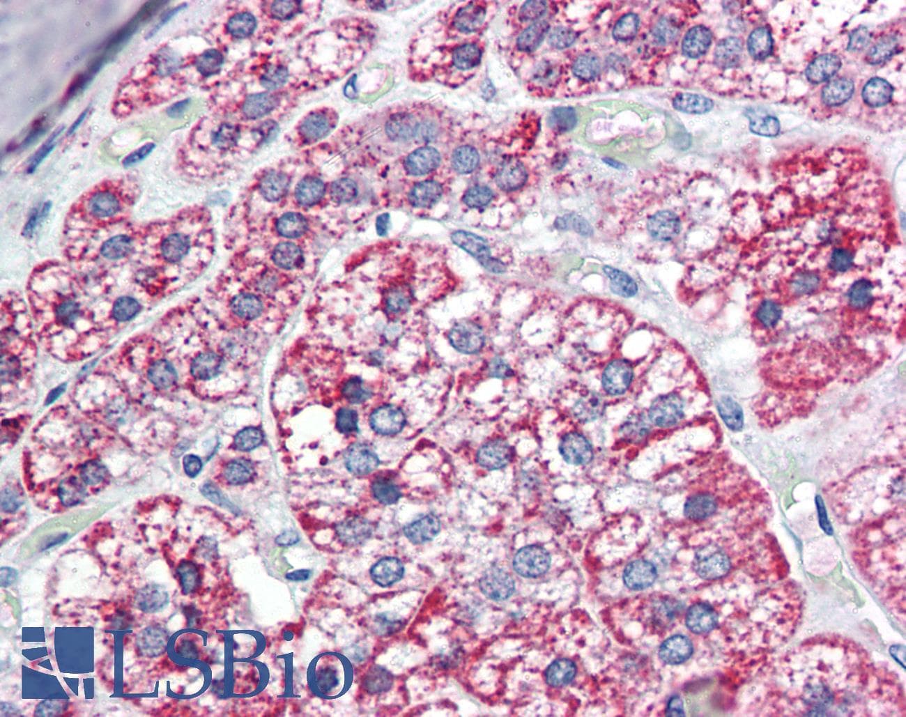 IHC-plus™ MCAD / ACADM Antibody (aa441-454)