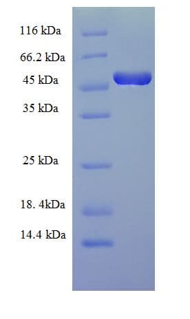Human FOSL2 / FRA-2 Protein (Recombinant His-SUMO)