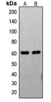 Polyclonal Rabbit anti-Human FASTK / FAST Antibody (Internal, IF, WB)