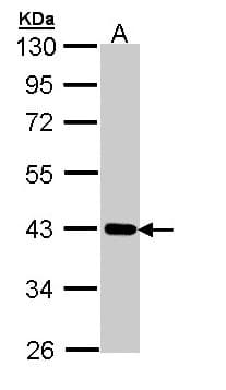 Polyclonal Rabbit anti-Human CRTAP Antibody (aa122-363, WB)