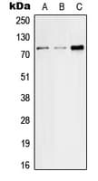 SLC5A2 / SGLT2 Antibody (Internal)