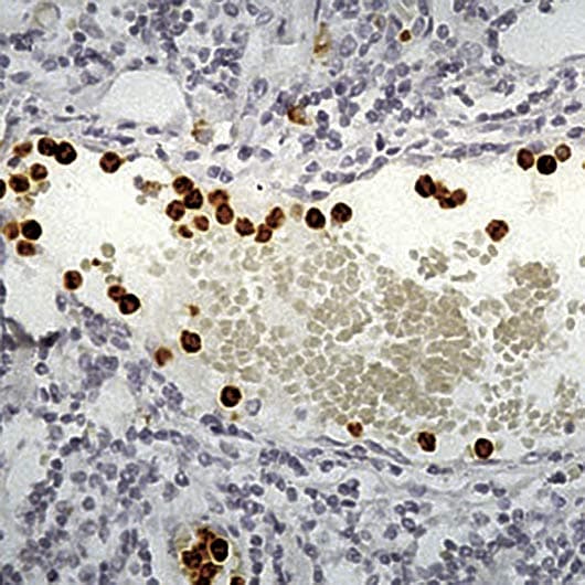 MPO / Myeloperoxidase Antibody