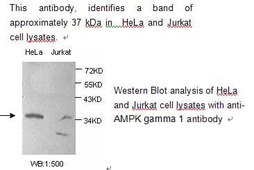 Polyclonal Rabbit anti-Human PRKAG1 / AMPK Gamma 1 Antibody (WB)