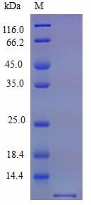 Mouse CCL5 / RANTES Protein (Recombinant)