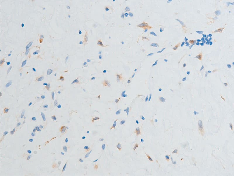 CHEK2 / CHK2 Antibody (phospho-Ser516)