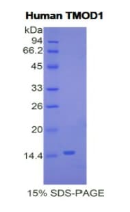 Human TMOD1 / Tropomodulin 1 Protein (Recombinant His)