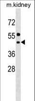 ALG11 Antibody (aa442-468)