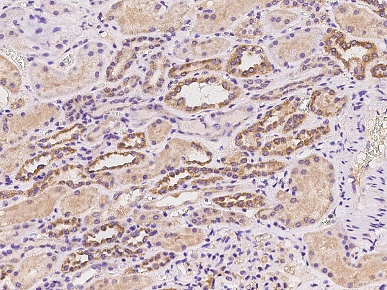 TMPRSS2 / Epitheliasin Antibody