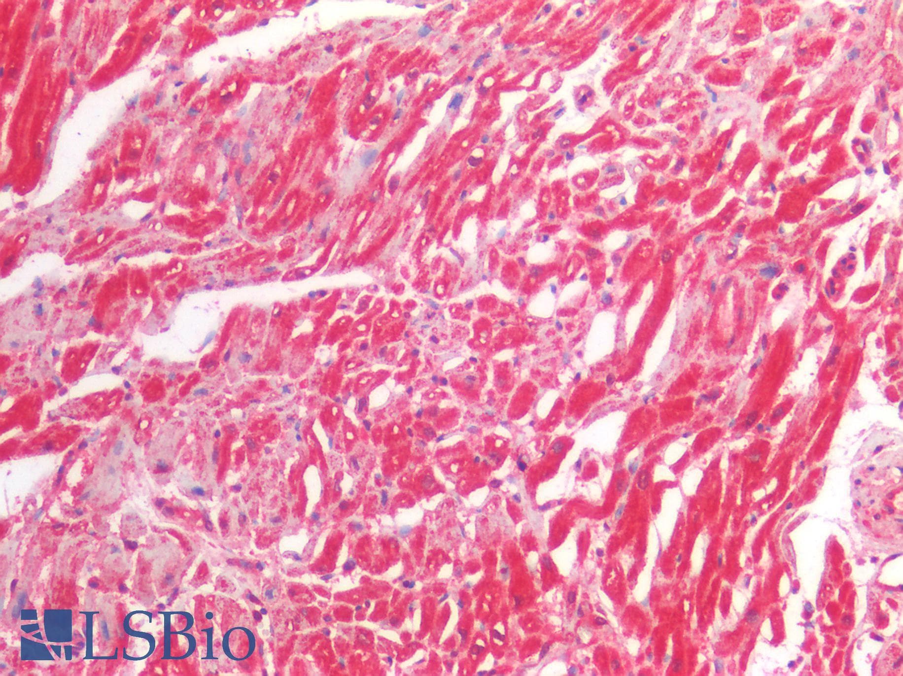 PathPlus™ Polyclonal Rabbit anti-Human RAB7A / RAB7 Antibody (IHC)