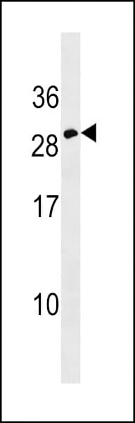 EPO / Erythropoietin Antibody (aa155-184)