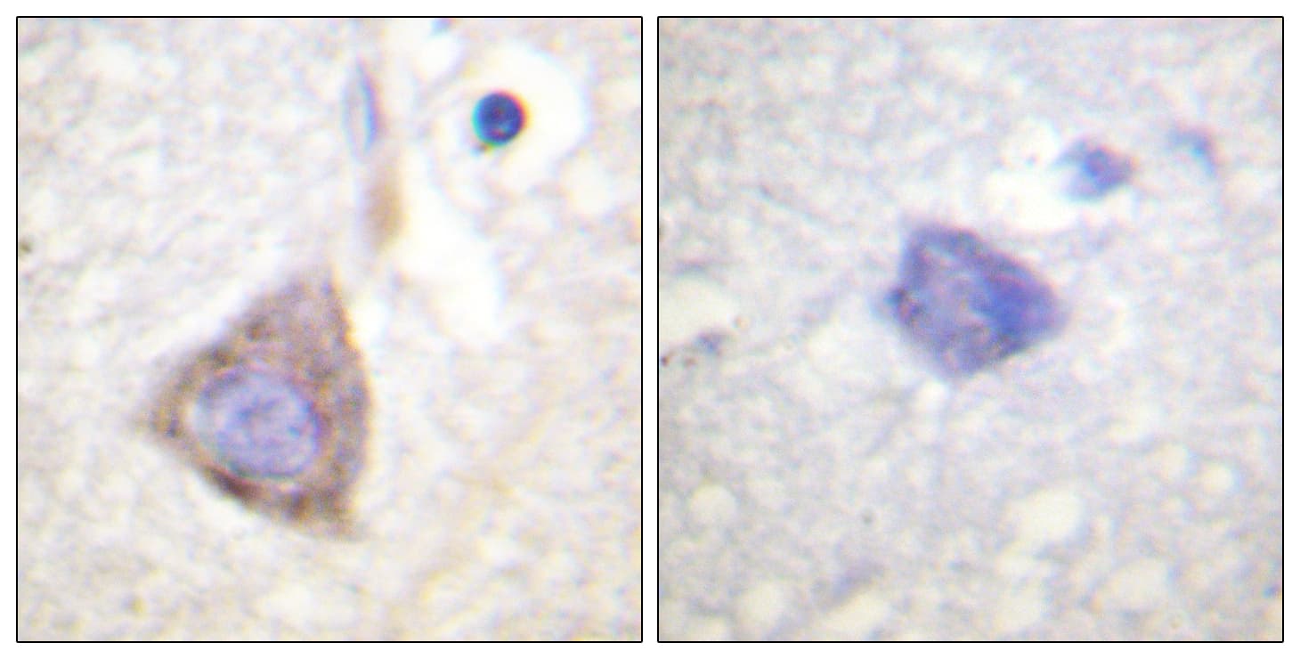 Polyclonal Rabbit anti-Human CML / BCR Antibody (aa331-380, IHC)