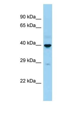 Polyclonal Rabbit anti-Human CD207 / Langerin Antibody (C-Terminus, WB)