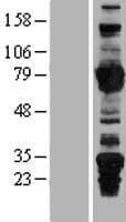 Human ARHGEF7 Protein (Over-Expression Lysate Myc-DDK (Flag))