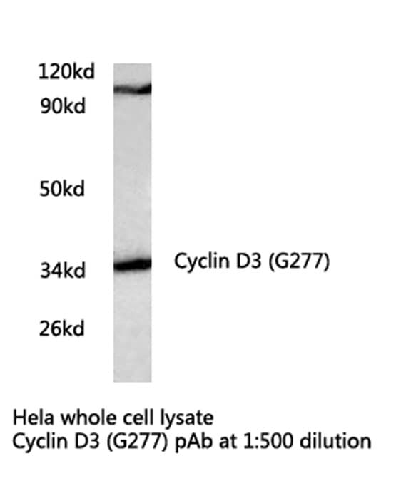 Polyclonal Rabbit anti-Human CCND3 / Cyclin D3 Antibody (Gly277, WB)