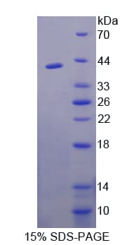 Human FKBPL Protein (Recombinant His-T7)