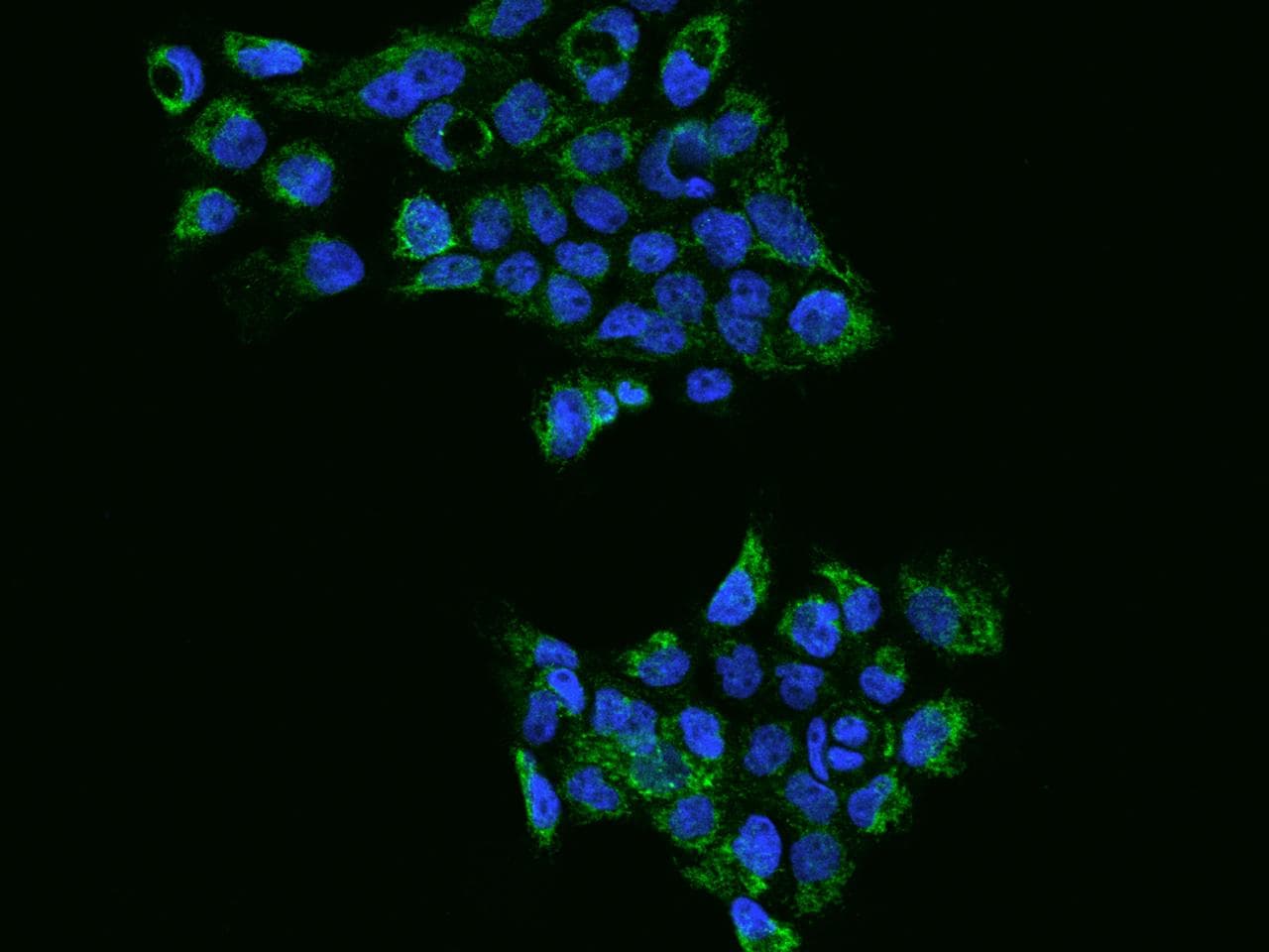 Polyclonal Rabbit anti-Human Rhodanese / TST Antibody (IHC, IF, WB)