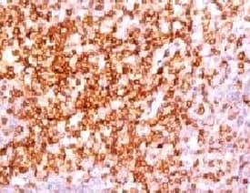 CD6 Antibody (clone CLDA6-1)