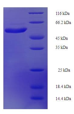 Human IL22RA1 / IL22R Protein (Recombinant His-SUMO)