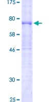 Human CD5 Protein (Recombinant GST)