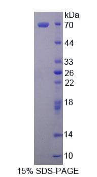 Human MARCKSL1 Protein (Recombinant His-GST, N-terminus)