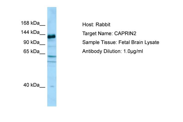 C1QDC1 / Caprin-2 Antibody (aa924-973)