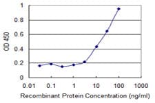 CPT2 Antibody (clone 1E10)