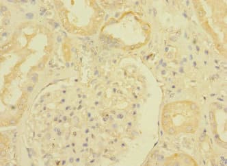 Polyclonal Rabbit anti-Human Betaglycan / TGFBR3 Antibody (IHC)