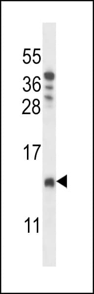 Polyclonal Rabbit anti-Human CHCHD8 Antibody (aa56-84, WB)