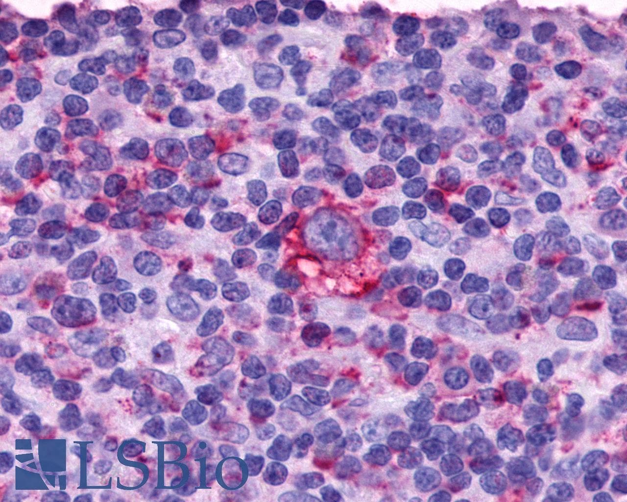 PathPlus™ ADGRE3 / EMR3 Antibody (N-Terminus)