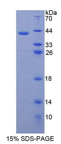 Human NPHS1 / Nephrin Protein (Recombinant His, N-Terminal)