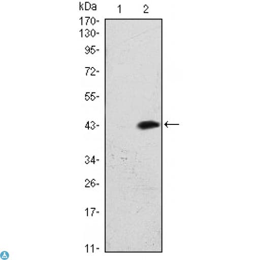 ATM Antibody