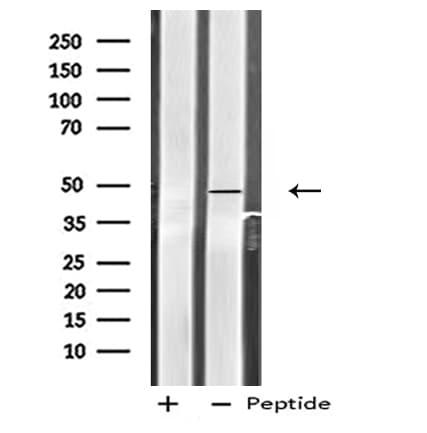 HTR2C / 5-HT2C Receptor Antibody