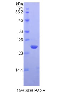 Human CBX3 / HP1 Gamma Protein (Recombinant His)