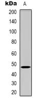 Polyclonal Rabbit anti-Human BMP12 / GDF7 Antibody (Internal, IHC, WB)