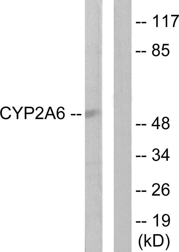 CYP2A6 Antibody
