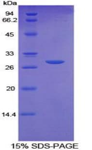Rat CD36 Protein (Recombinant His-T7)