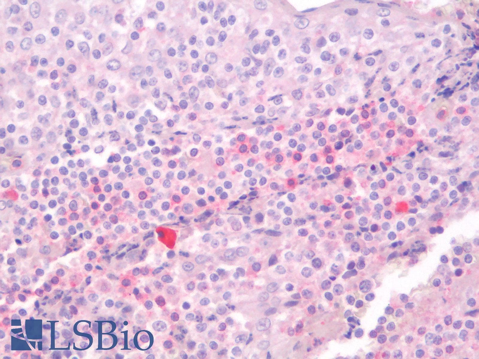 PathPlus™ CD3E Antibody