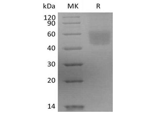 Human IL3RA / CD123 Protein (Recombinant 6His, C-terminus)
